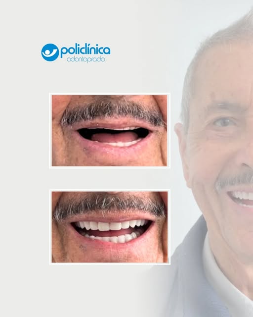 Post do Instagram da Odontoprado